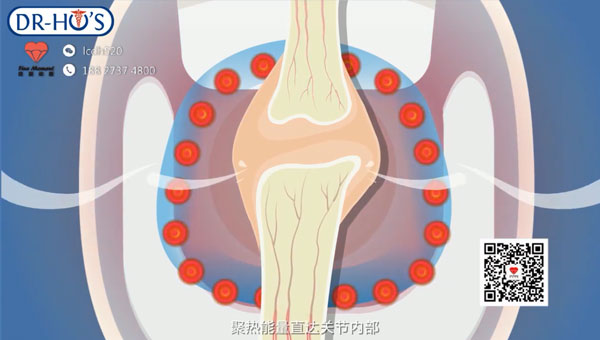 产品介绍动画制作 DR-HO'S膝关节理疗仪